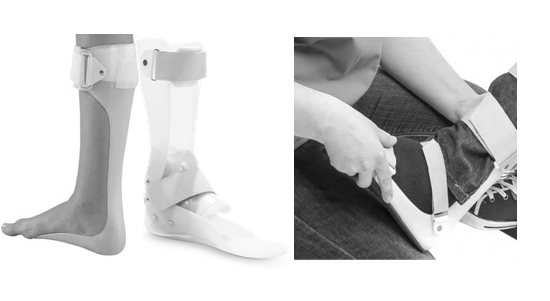 Types of Ankle Foot Orthosis